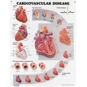 Lww Cardiovascular Disease Anatomical Chart Laminated 