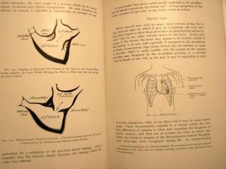   Medical illustrated Book Nearly 100 years old! Physical Diagnosis