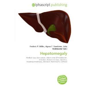  Hepatomegaly (9786134151528): Books